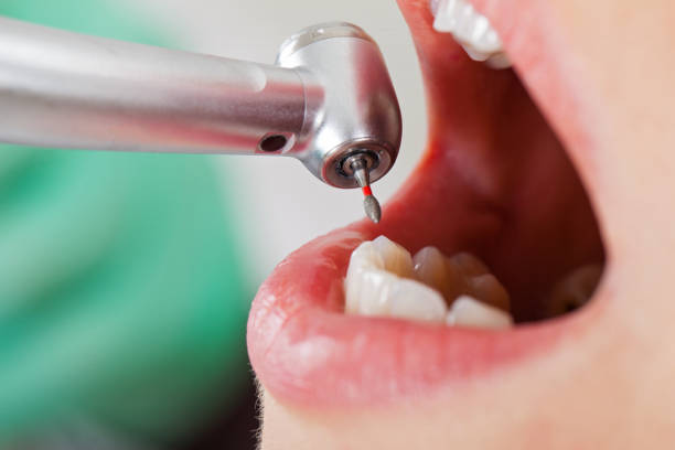 Best Pediatric Emergency Dentist in Fussels Corner, FL